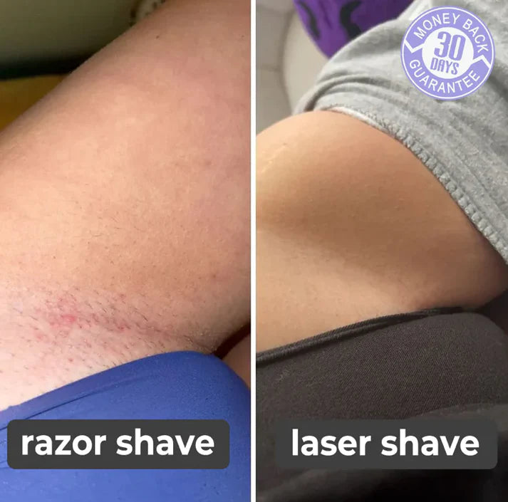 Painless Hair Remover